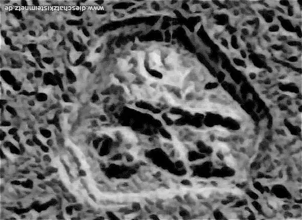 ausschnitt-schatzkiste (1).webp